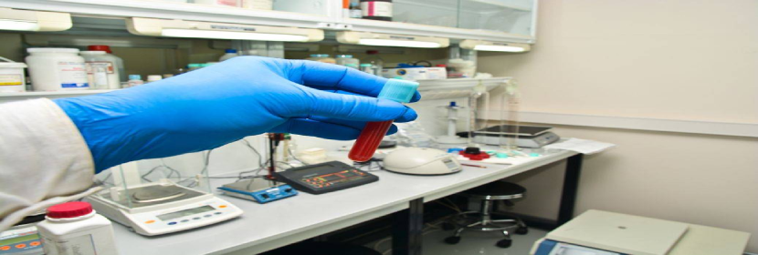 溶血性链球菌检测