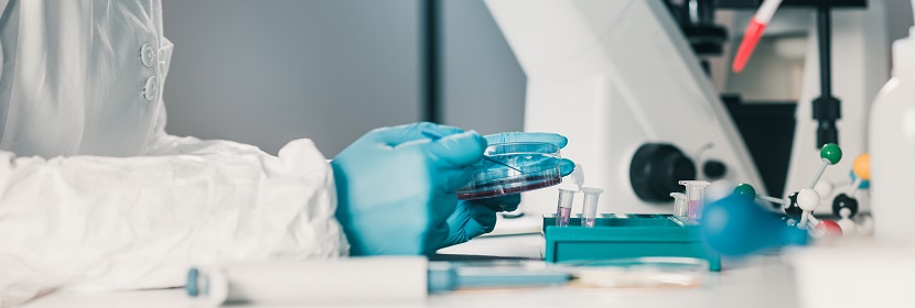 超高分子量聚乙烯管件检测