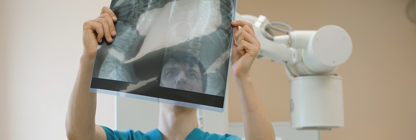 移动CR放射卫生检测评价