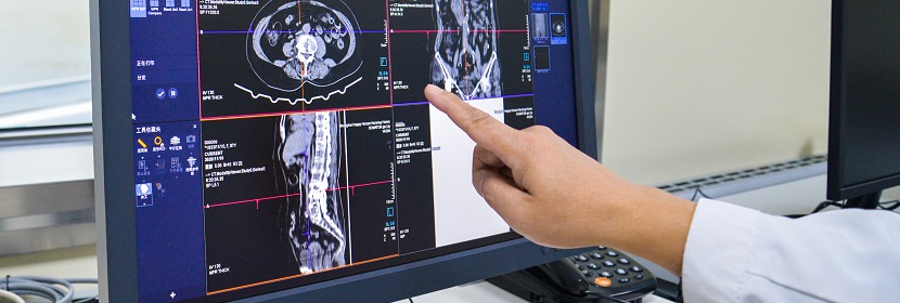 X射线计算机体层摄影(CT)装置放射卫生检测评价