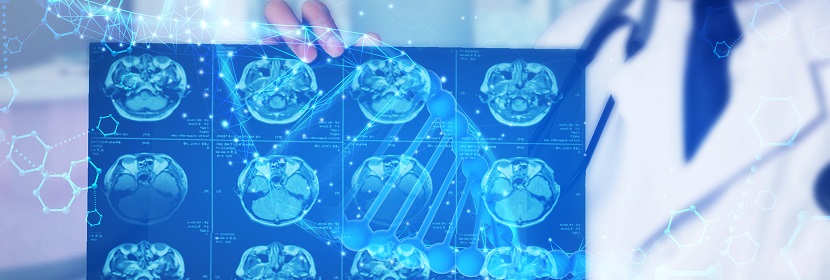 DSA(数字减影血管造影)放射卫生检测评价