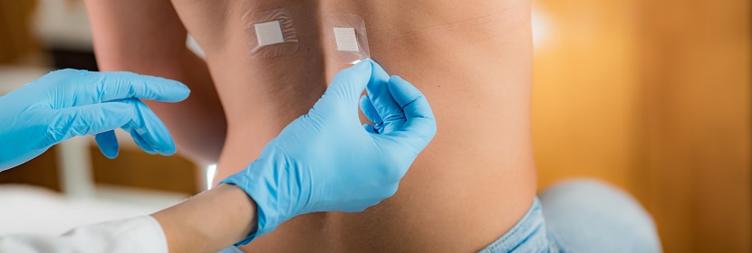 皮肤光变态反应试验