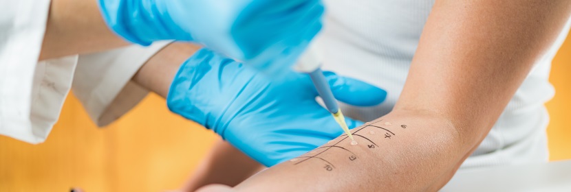 化学品急性皮肤刺激性/腐蚀性试验