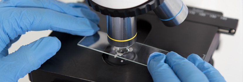 六次甲基四胺检测