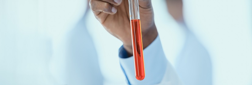 硫化促进剂ZEHBP检测